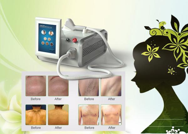 800-810nm wavelength Big spot size 12mm*20mm beautiful 808 diode hair removal machine