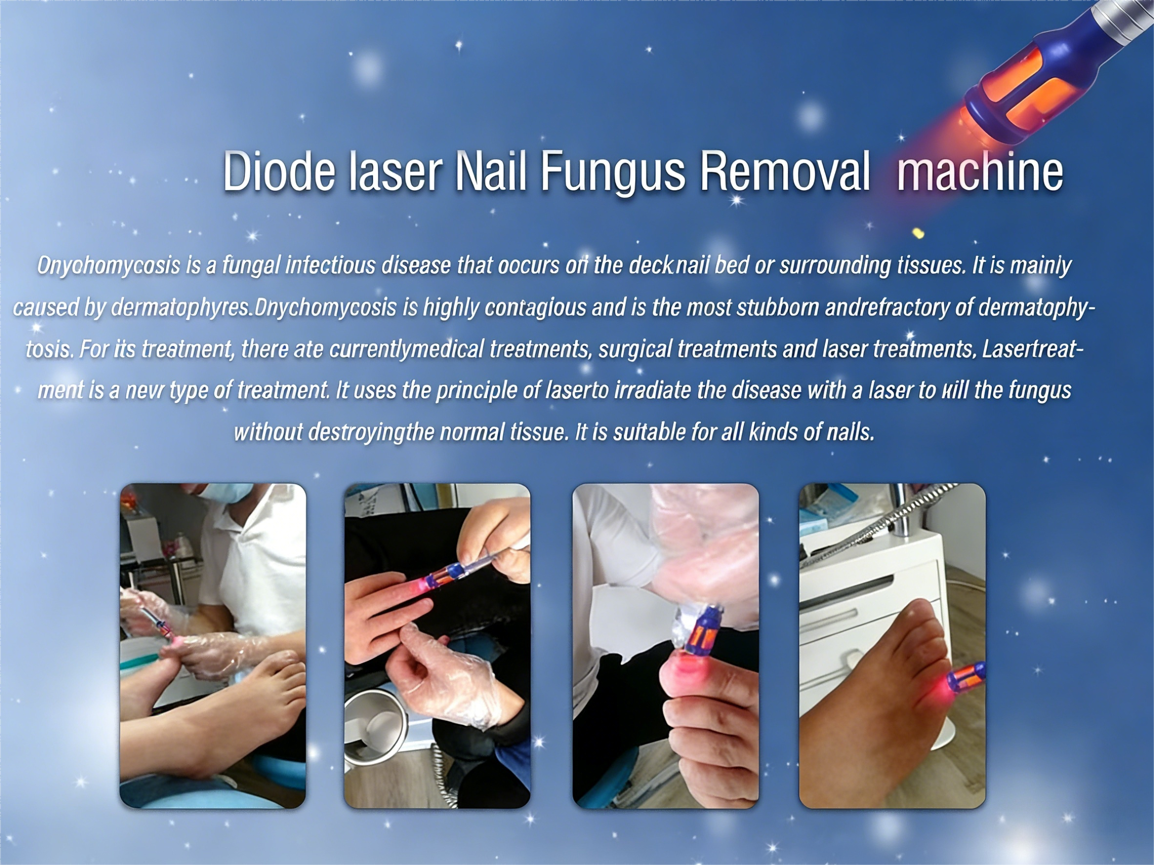 980nm Diode Laser Machine , Nail Fungus Laser Machine 30W With 7 Inch Touch Screen