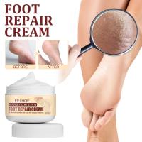 OEM ODM Creme de cuidados com as mãos e os pés Anti-cracking Peeling seco Reparação de rachaduras