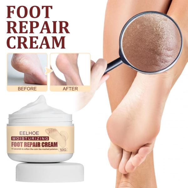 OEM ODM Creme de cuidados com as mãos e os pés Anti-cracking Peeling seco Reparação de rachaduras