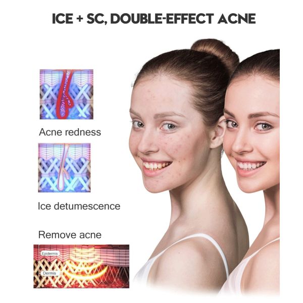 Permanent IPL Hair Removal Epilator Depilatory ICE Cool Laser Full Body Use