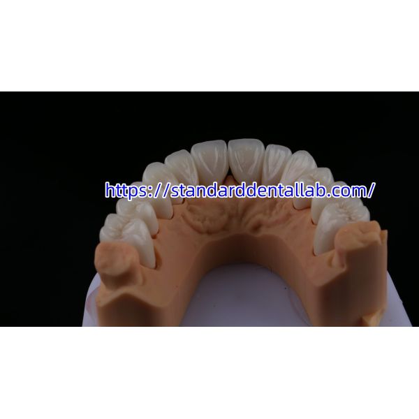 FDA высокая эстетика зубной цирконий мост с слоистыми фарфоровой цирконии зубной короны Китай стоматологическая лаборатория