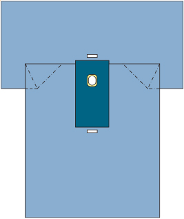 SP SMS SMMS SMMMS Neonatal Pediatric Sterile Disposable Drapes 40g 60g
