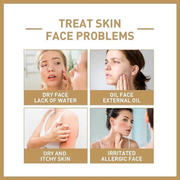 OBM OEM Factory Wholesale Price Whitening Korean Skin Care Facial Toner Hydration Rice Toner Water Nicotinamide for Dry Skin