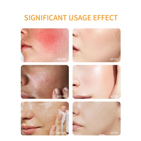 OEM Skincare Face Serum Moisturizing Cream Waterproof Spf50 Sunscreen Spray