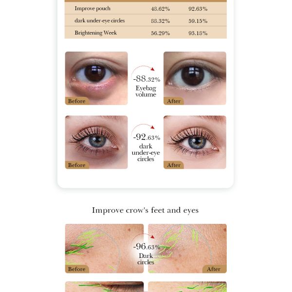 Увлажнение Противоморозки Старение Коллаген глазная маска облегчить усталость пластырь Уход за кожей