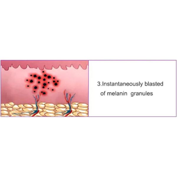 Professional High Power Q Switch ND YAG Laser Machine With Double Cooling Radiators