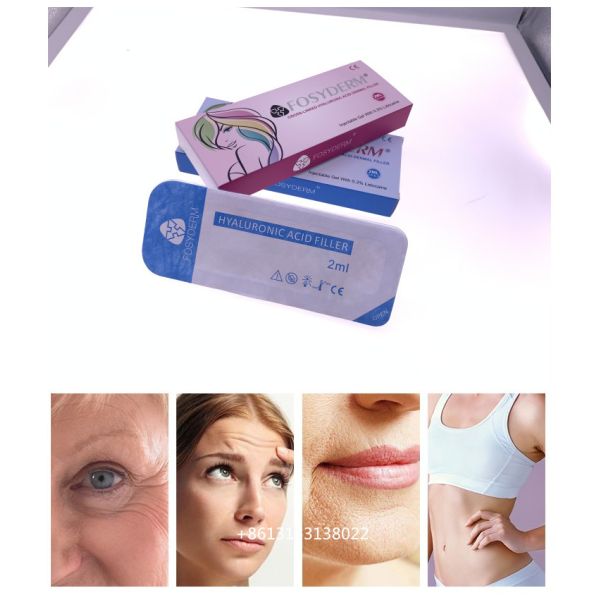 2 ml de remplissage en profondeur lié à l'acide hyaluronique pour le menton et le nez