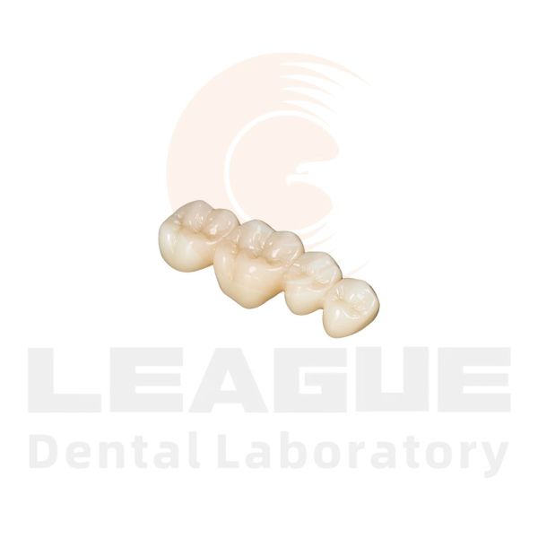 Porcelain Fused To Metal PFM Crown Metal Ceramic Crown Accurate Fit