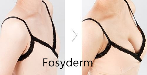 Впрыска Fosyderm заполнителя пениса батокс и людей груди Subskin дермальная