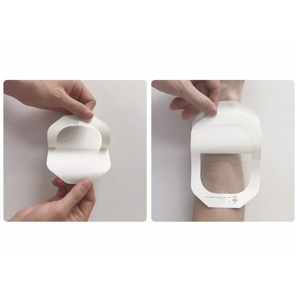 Canules Iv stériles de film transparent chirurgical d'unité centrale de pansement auto-adhésif