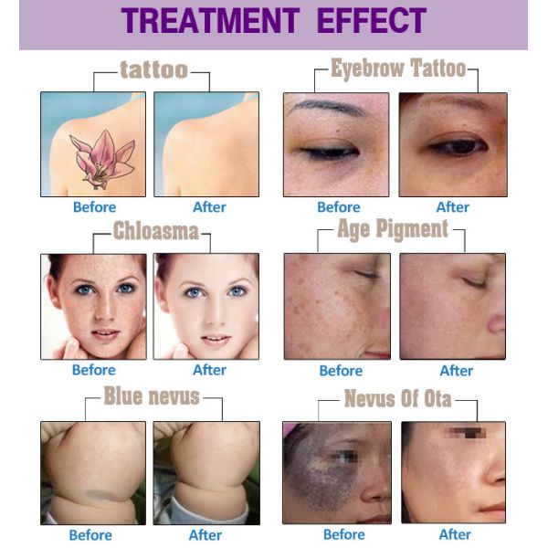 3mm 1064 Nm q переключили пикосекунду 532nm лазера ND YAG регулируемую