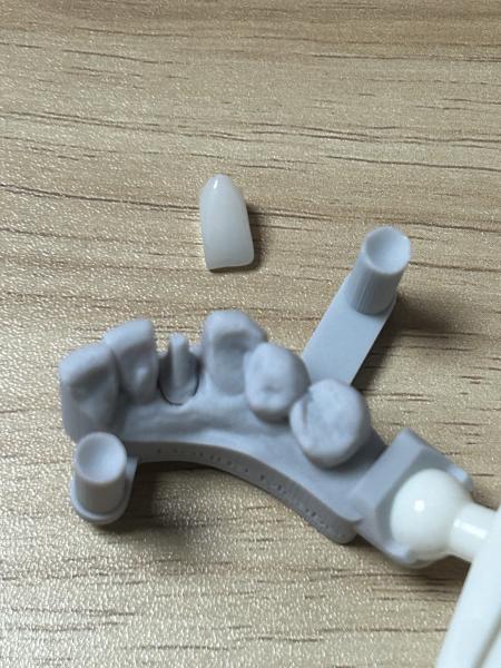 Premium Monolithic Zirconia Crown with High Flexural Strength and CAD/CAM Digital Technology for Dental Restoration