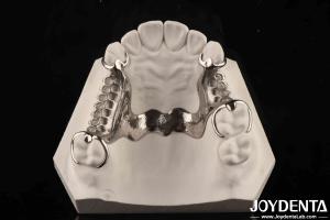 Clinical Practice Dental Alloying Metal Framework Good Fit In The Mouth