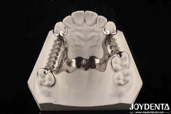 Clinical Practice Dental Alloying Metal Framework Good Fit In The Mouth Technology