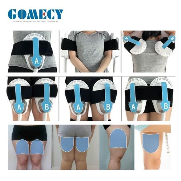 360° Semiconductor Surround Cooling Cryolipolysis Slimming Machine with 7 Tesla HI-EMT Muscle Stimulation and 0℃ to -11℃ Adjustable Cooling