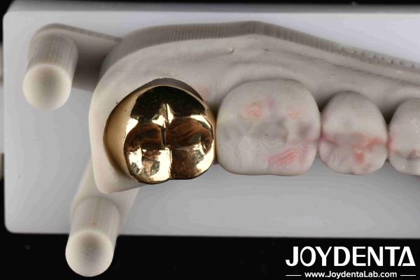 Professional Grade Gold Crown For Dental Oral Clinical Application Yes Abrasive Resistance