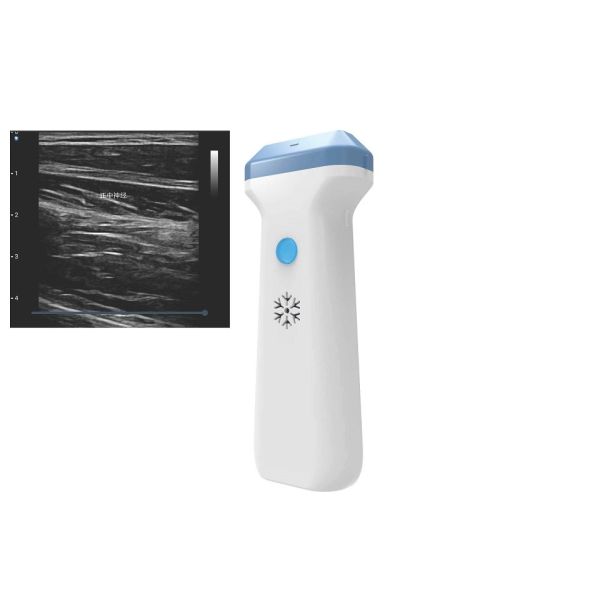 DICOM BMP PNG JPEG 128 Element Wifi Ultrasound Probe 80 To180dB