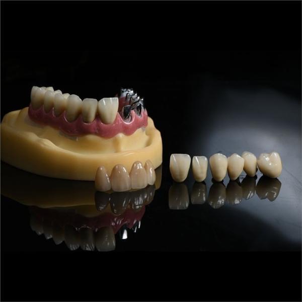 Cad Cam Implant PFM Crown Bridge Dental Medical Grade Adhesive