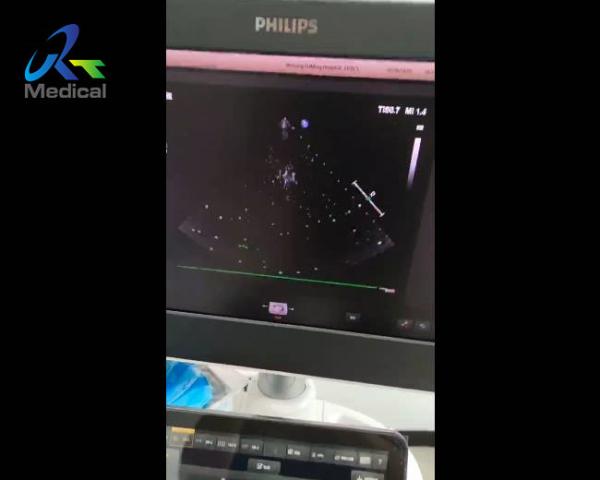 EPIQ 5 Ultrasound Machine Repair Abnormal Image Snowflake Interference Replace ACQ