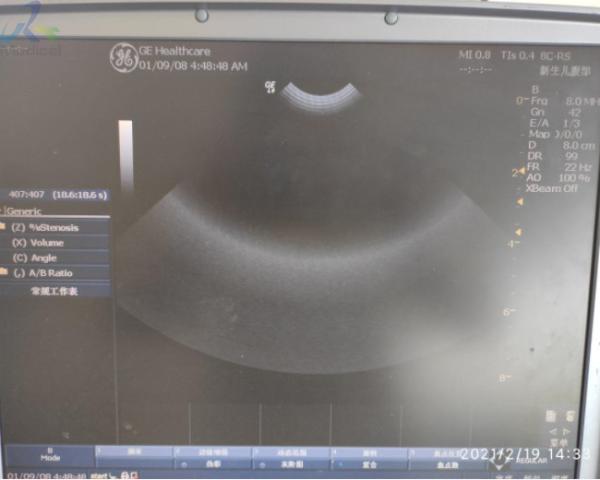 GE 6S-RS Phased Ultrasonic Transducer Sonography Hospital Clinic
