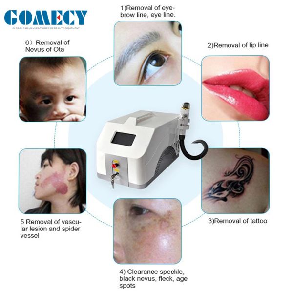 1064nm 532nm 1320nm Q Switch Nd YAG Лазерная машина для удаления татуировок с карбоновым пилингом