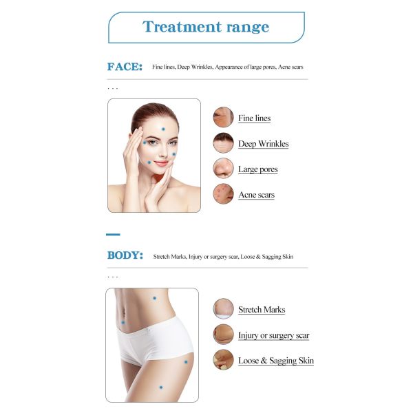 Appareil de rajeunissement de la peau par radiofréquence Équipement de lifting du visage non chirurgical AC220V 110V