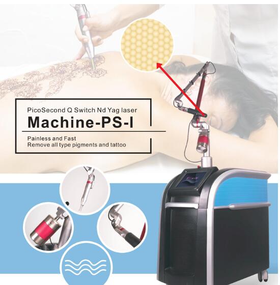 Удаление татуировки брови лазера машины удаления татуировки лазера НД Яг пикосекунды