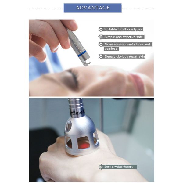 машина удаления машины удаления Varicose вены 40W 980nm высокочастотная васкулярная