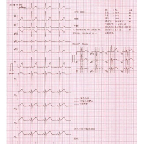 Cheap health care ecg machine medical medical electrocardiogram ecg machine CE approved factory ecg machine for hospital