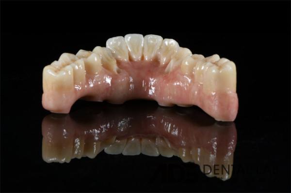 OEM Cylindrical Titanium Full Bridge Dental Implants All On 4 6