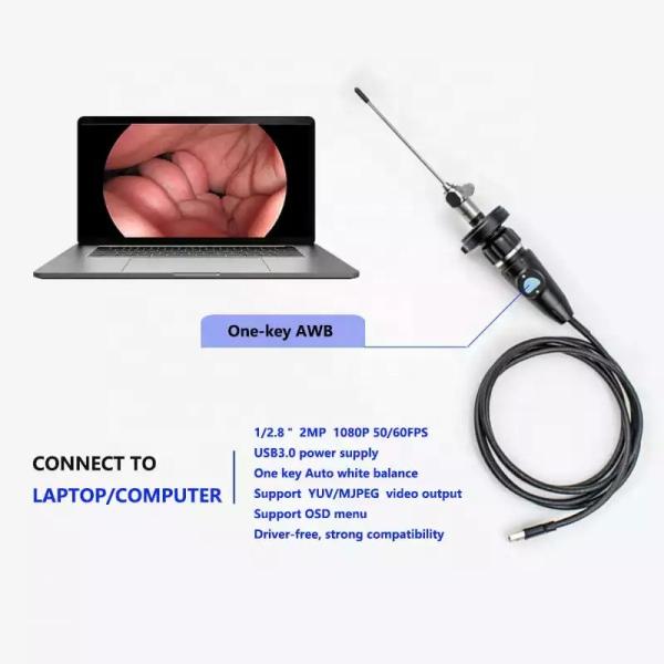 CE Certified USB3.0 HD 1080P C Mount Portable Endoscopy Camera With High Resolution CMOS