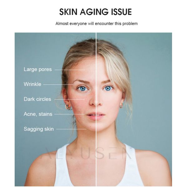 Машина красоты гидры кожи слезает лицевое оборудование двигателя кислорода Dermabrasion