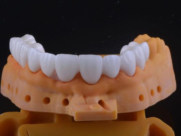 High Strength Zirconia Tooth Crown Ultra Translucent With Long Term Stable