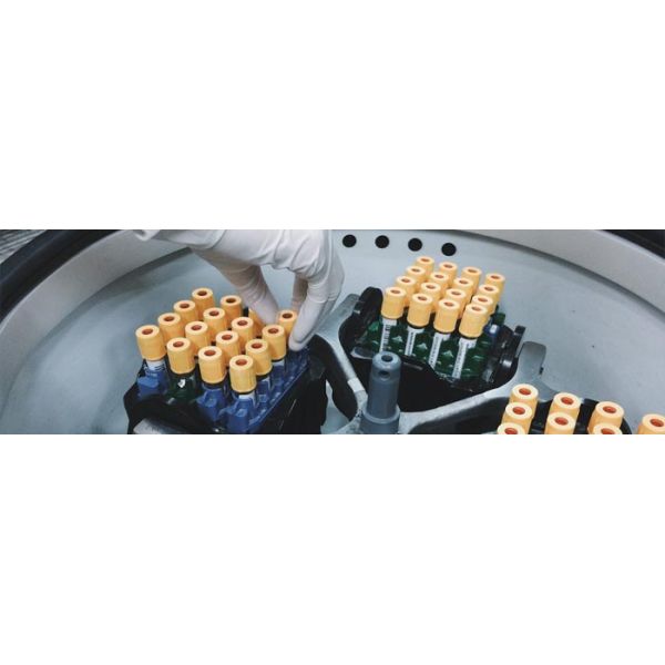 Sistema de Detecção de Defeitos de Superfície de Tubo de Centrífuga de Plástico Médico