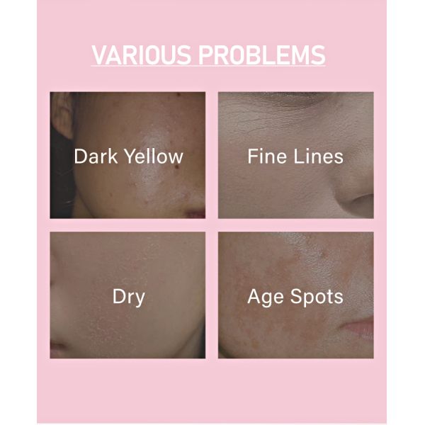 FAIENCE MAGIC OEM 5 in 1 Face Serum with Whitening Firming Anti-wrinkle Anti-aging Keep Moisturize Pale Spots for Home Use