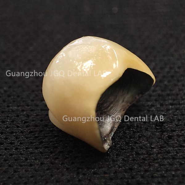 Porcelain Metal Crowns Fixed Denture Restorations Metal Pfm Custom China Dental Lab