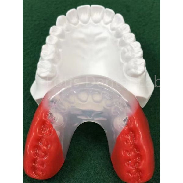 Aparelhos ortodônticos de grau médico para alinhamento perfeito dos dentes