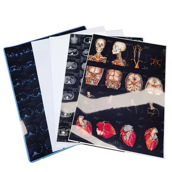 Canon/Epson чернила совместимые медицинские рентгеновские пленки 9600x2400dpi высокое разрешение