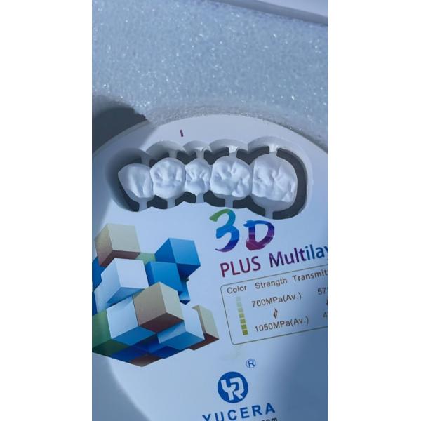 Yucera Advanced Dental Scanner with Software Bundle - Enhance Your Practice