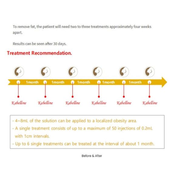 Уменьшение веса Kabelline Растворяющий жир Раствор для инъекций Кибелла дезоксихоловая кислота