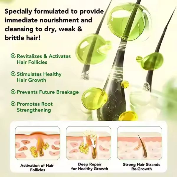 Suero para el cuidado del cuero cabelludo con romero infundido OEM Productos para el cuidado del cabello personalizados