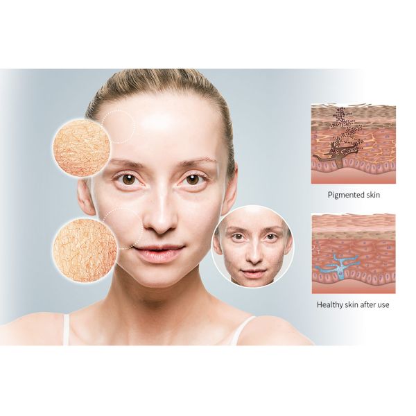 Multicolor пусковая площадка терапией света СИД облегчения боли 210pcs для клиники