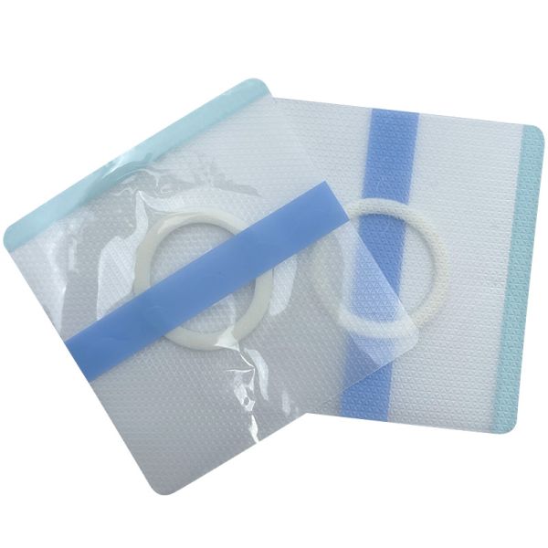 Skin Friendly Breathable Clear Wound Dressings for Baby's Navel Neonatal Hip Hernia