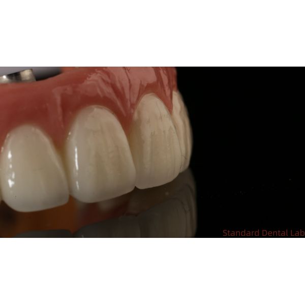 Professional Zirconia Dental Implant Crown Titanium CAD CAM Zirconia Crown China Dental Lab