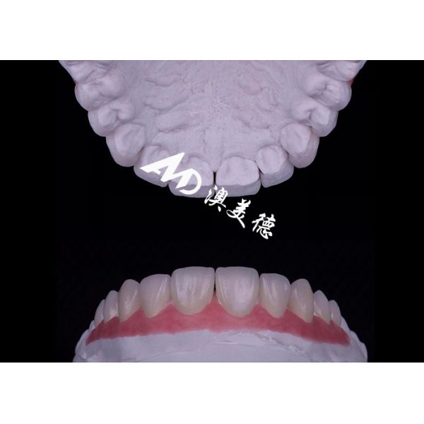 透明性 EMAX ポルセラン フェニエール 汚れ耐性/強度