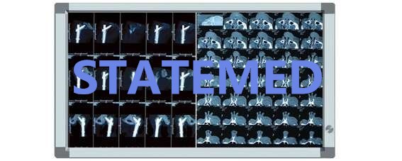 Ultra Thin LED X Ray Film Viewer High Brightness All Metal Structure 792 * 488 * 21mm