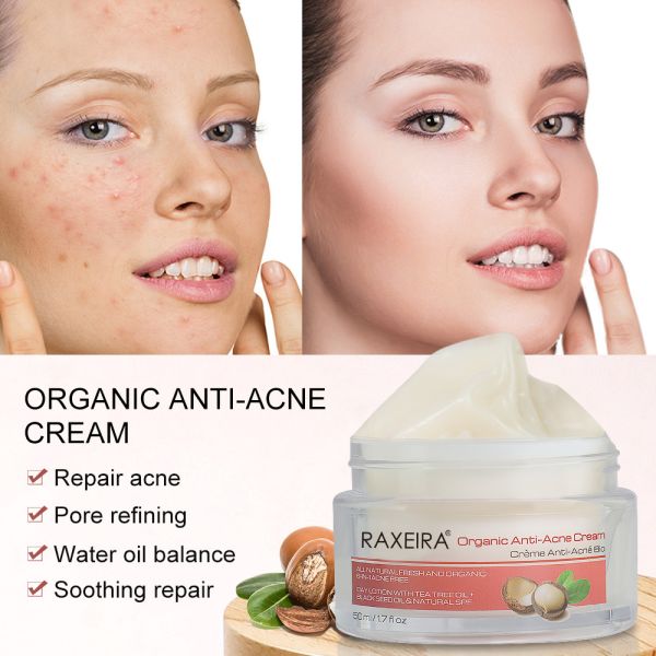 Organic Anti Acne Cream For Face With Macadamia Seed  Jojoba Seed Oil