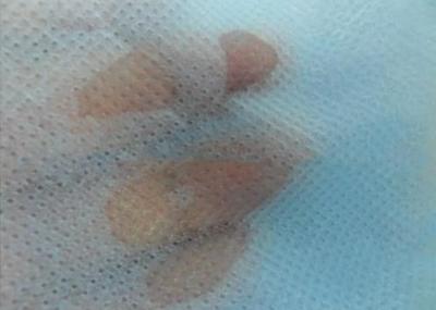Nontoxic SMS Non Woven Fabric Eco - Friendly Hydrophobic Waterproof For Diapers