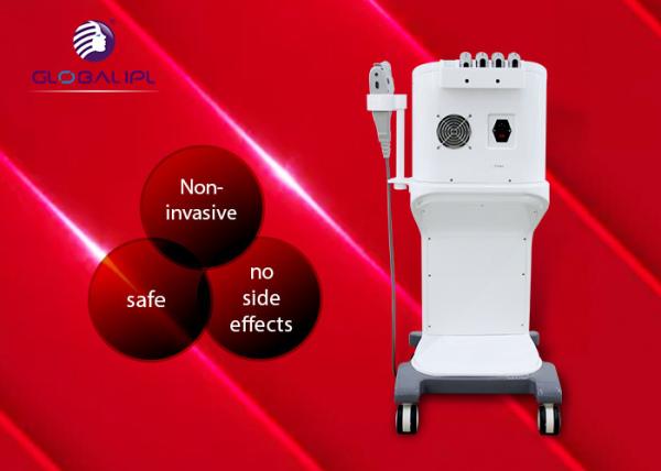 Non Invasive Hifu Facelift Machine Face Wrinkle Remover Machine 4.0 MHz